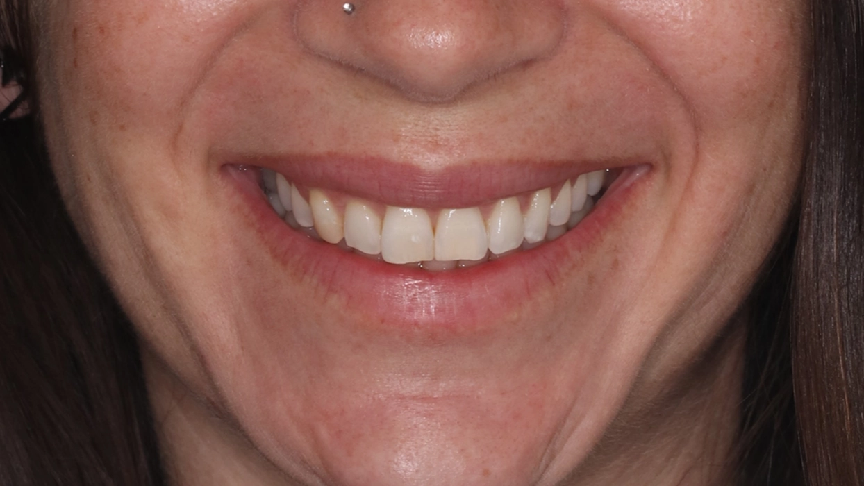 CAROL ANTES SORRINDO