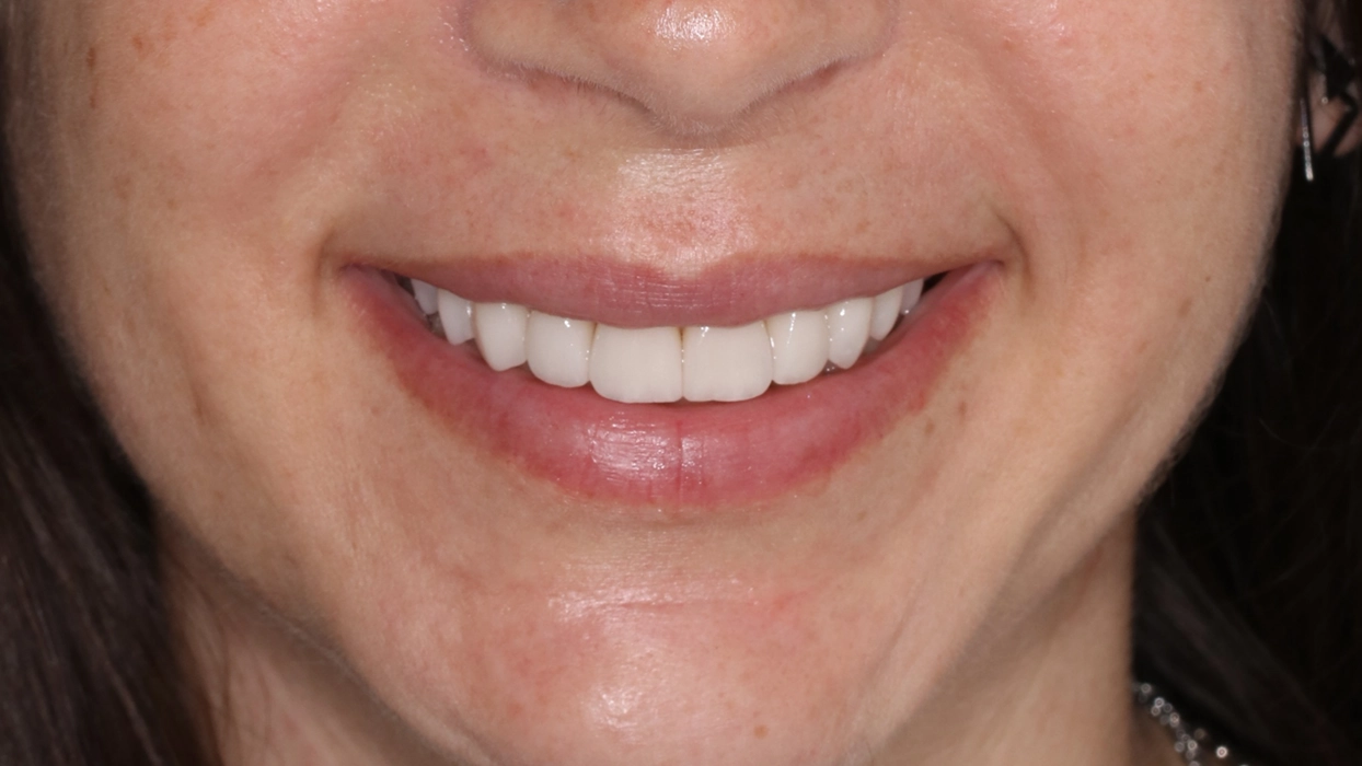 CAROL DEPOIS SORRINDO