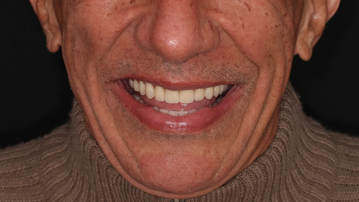 vanderley DEPOIS sorrindo